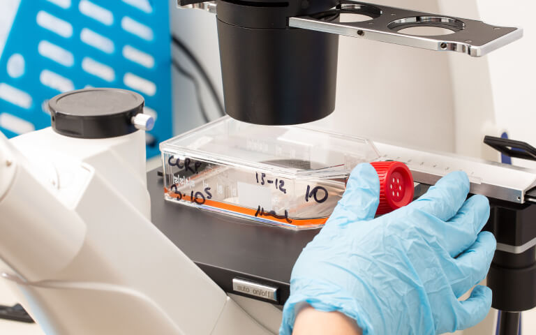 Reliable and Cost-Effective GMP Activin A and KGF Enable Scalable iPSC-Derived Islet Cell Manufacturing for Diabetes Therapy
